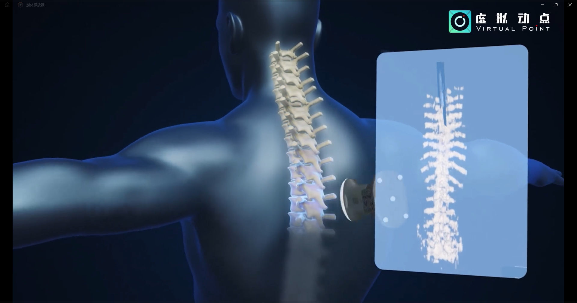 今年会·(jinnianhui)金字招牌·虚拟动点OptiTrack开创3D超声成像在脊柱诊断中的应用